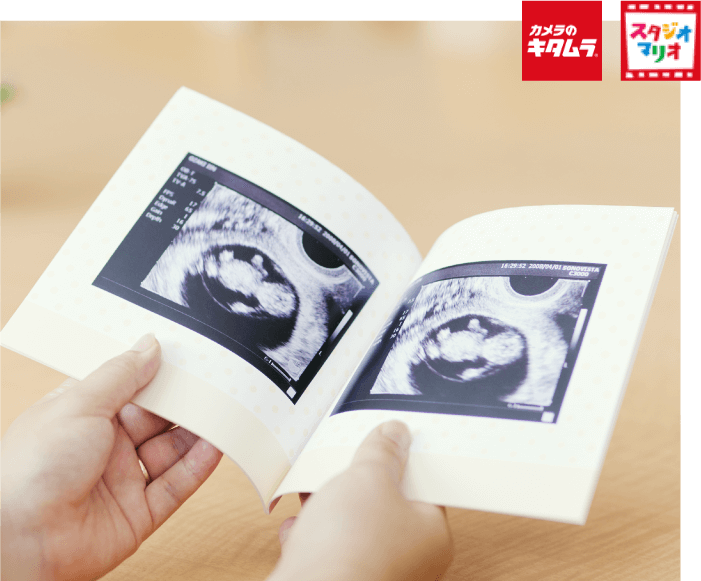 02 念願の第一子妊娠の画像